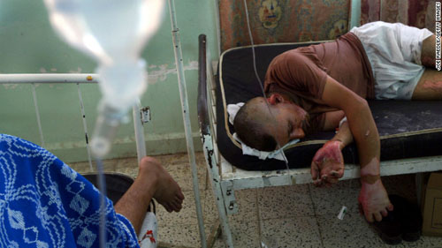 2004年8月3日，伊拉克国民警卫队士兵阿卜杜勒・卡里姆躺在医院的病床上，他在阿古柏的一家检查站上遭遇汽车炸弹爆炸，身受重伤。伊拉克当局表示，炸弹导致六名卫兵死亡，六人重伤。（图片来自CNN网站）