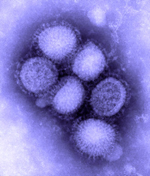 日本科学家拍摄出甲型H1N1流感病毒真面目